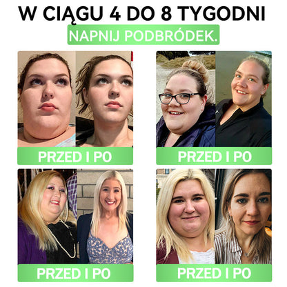 🧡ANGELTRAP® Moringa × Berberyna × AMPK 10-w-1 Wsparcie metaboliczne, plaster z nanotechnologią mikroigłową 🇵🇱(Wystarczy raz dziennie, widoczne efekty w 7 dni) ✅ Na otyłość, wiotką skórę, cukrzycę, bezdech senny, problemy ze stawami i wiele innych