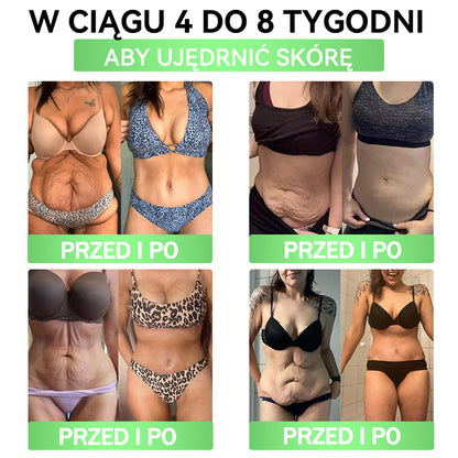 🧡ANGELTRAP® Moringa × Berberyna × AMPK 10-w-1 Wsparcie metaboliczne, plaster z nanotechnologią mikroigłową 🇵🇱(Wystarczy raz dziennie, widoczne efekty w 7 dni) ✅ Na otyłość, wiotką skórę, cukrzycę, bezdech senny, problemy ze stawami i wiele innych