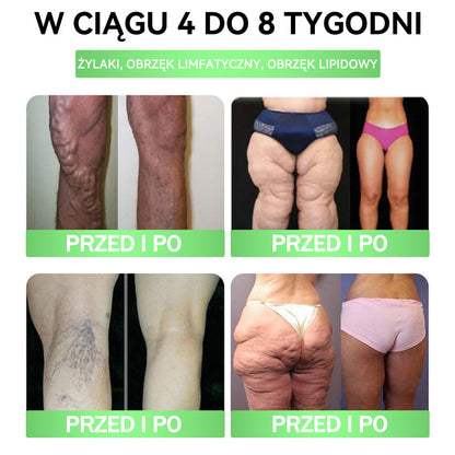 🧡ANGELTRAP® Moringa × Berberyna × AMPK 10-w-1 Wsparcie metaboliczne, plaster z nanotechnologią mikroigłową 🇵🇱(Wystarczy raz dziennie, widoczne efekty w 7 dni) ✅ Na otyłość, wiotką skórę, cukrzycę, bezdech senny, problemy ze stawami i wiele innych