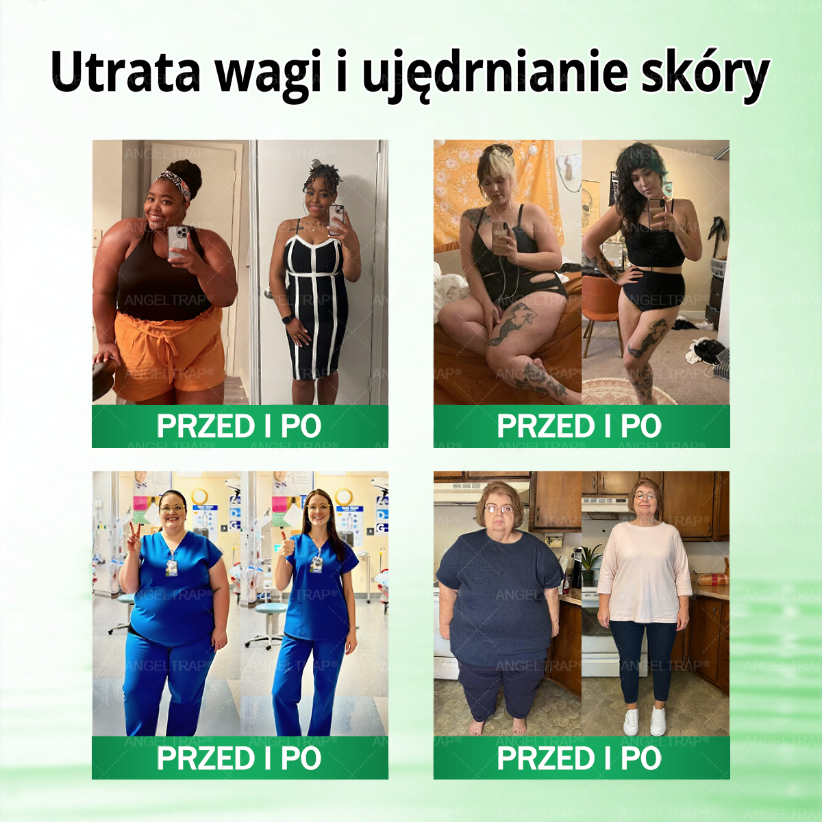 🧡ANGELTRAP® Moringa × Berberyna × AMPK 10-w-1 Wsparcie metaboliczne, plaster z nanotechnologią mikroigłową 🇵🇱(Wystarczy raz dziennie, widoczne efekty w 7 dni) ✅ Na otyłość, wiotką skórę, cukrzycę, bezdech senny, problemy ze stawami i wiele innych