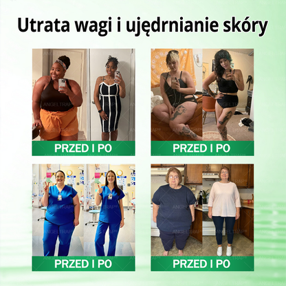 🧡ANGELTRAP® Moringa × Berberyna × AMPK 10-w-1 Wsparcie metaboliczne, plaster z nanotechnologią mikroigłową 🇵🇱(Wystarczy raz dziennie, widoczne efekty w 7 dni) ✅ Na otyłość, wiotką skórę, cukrzycę, bezdech senny, problemy ze stawami i wiele innych